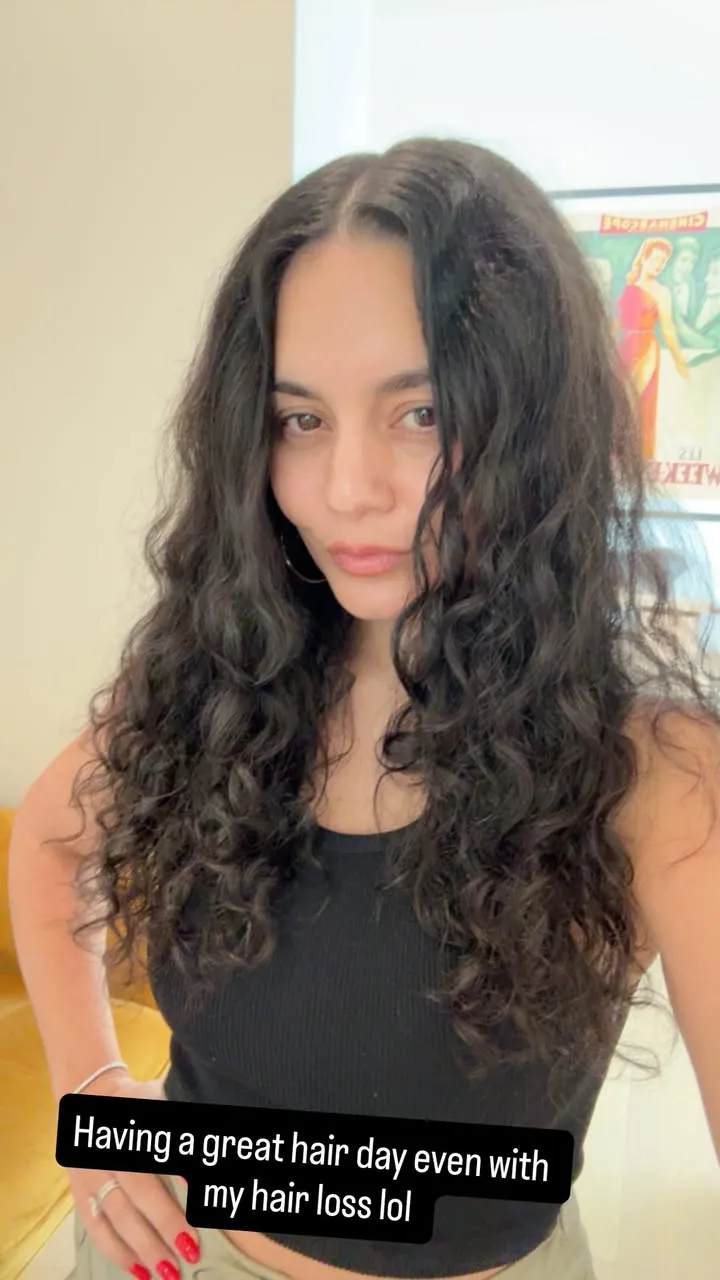 Vanessa Hudgens Shares Postpartum Hair Loss After Welcoming Baby No. 2