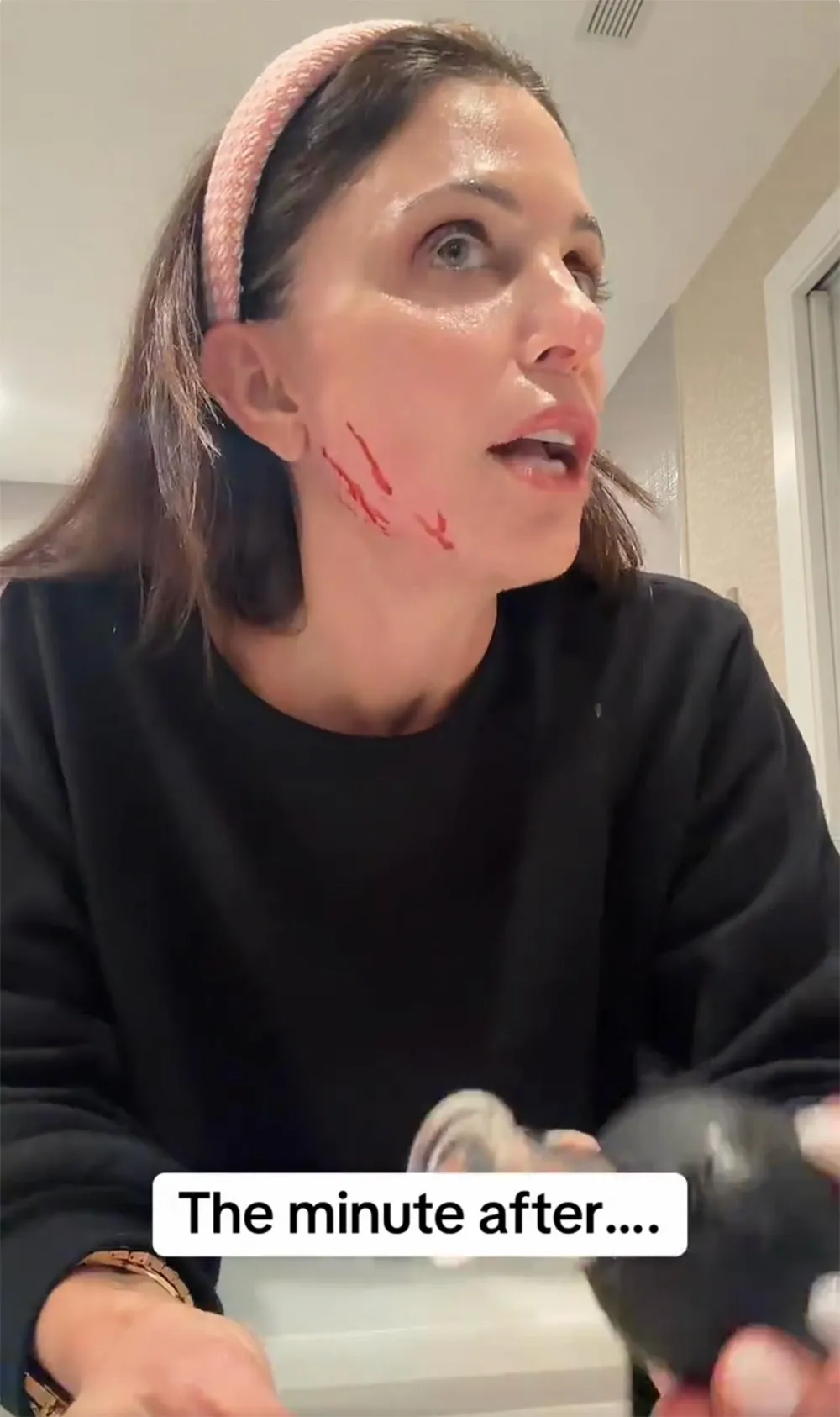 What Happened to Bethenny Frankels Face Nurse Jamie Controversy Explained