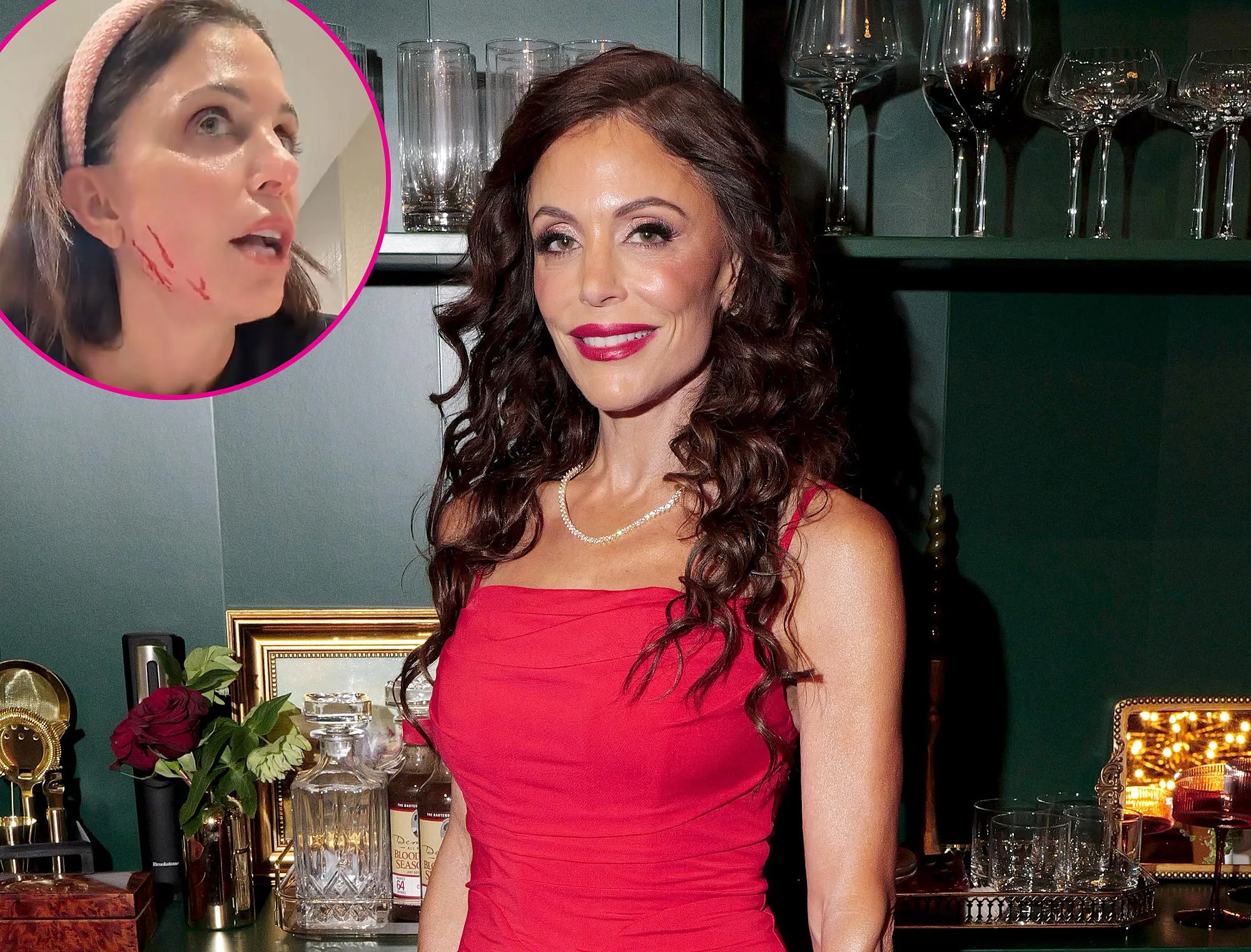 What Happened to Bethenny Frankels Face Nurse Jamie Controversy Explained