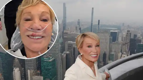Barbara Corcoran Shares Gory Pic After Tripping and Breaking Her Tooth: ‘Lip Barely Hanging On’