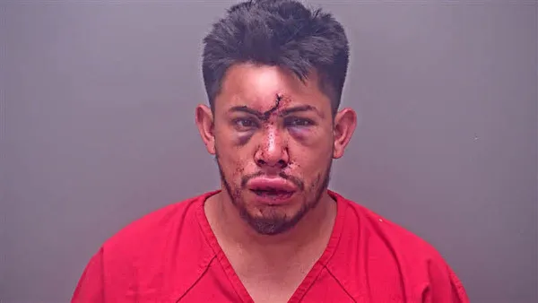 13-Year-Old Boy Knocked Out Drunken Dad to Stop Him From Strangling Mother in Domestic Altercation