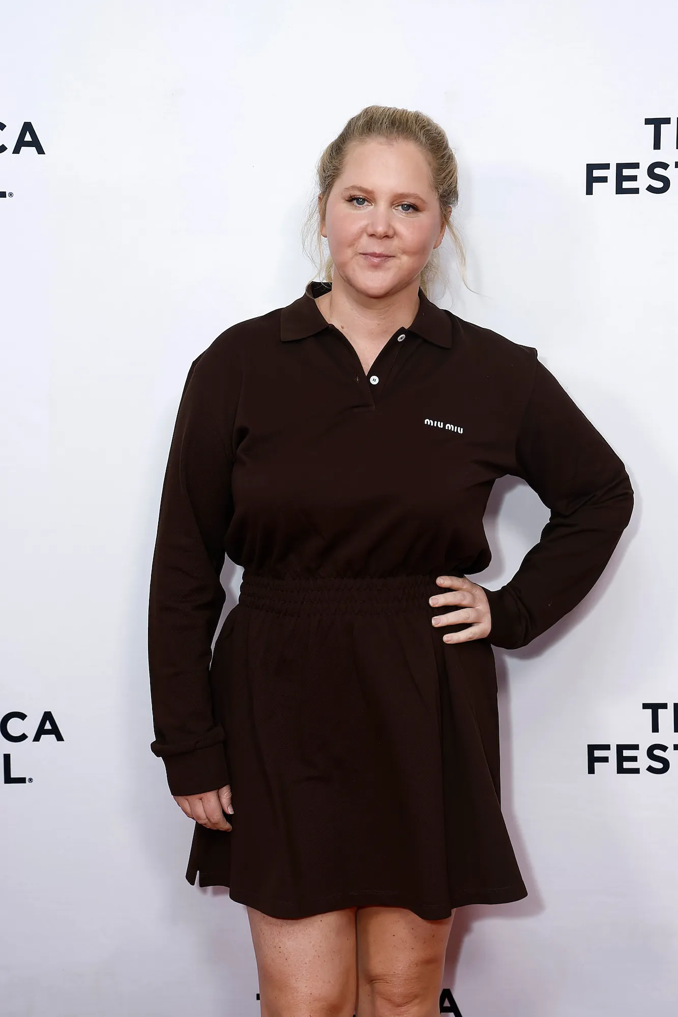 Amy Schumer Quotes on Weight Loss and Body Image GettyImages-2220191454