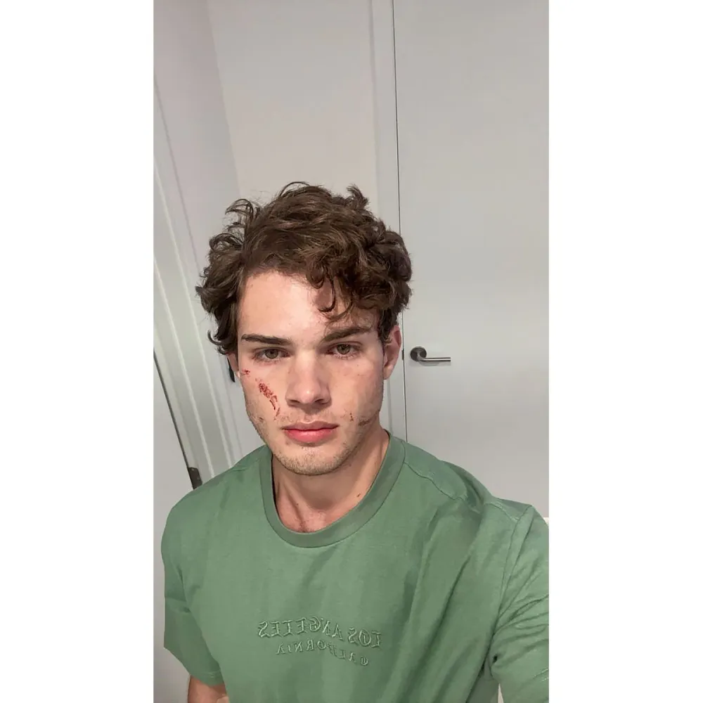 Clavicular Speaks Out