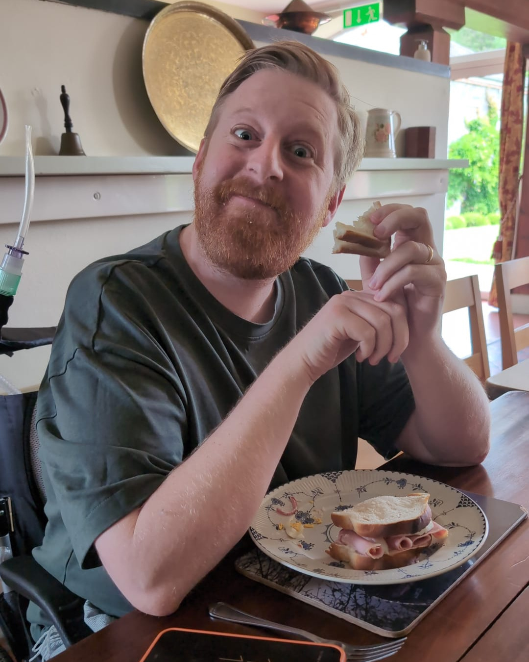 Everything Game of Thrones Actor Michael Patrick Said About MND Before Death