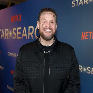 Jelly Roll Details Setback in Weight Loss Journey