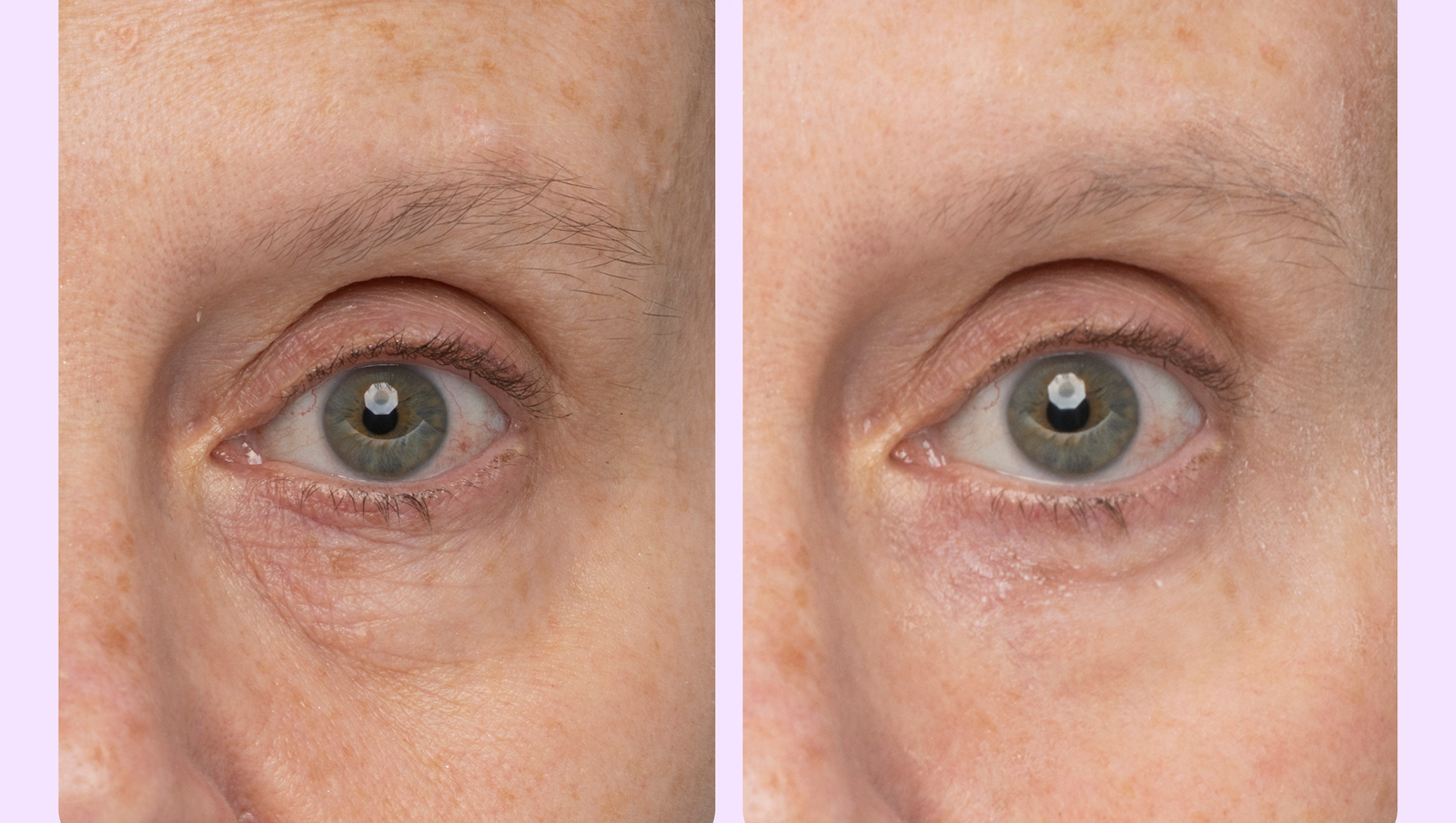 goPure Instant Lift Eye Gel