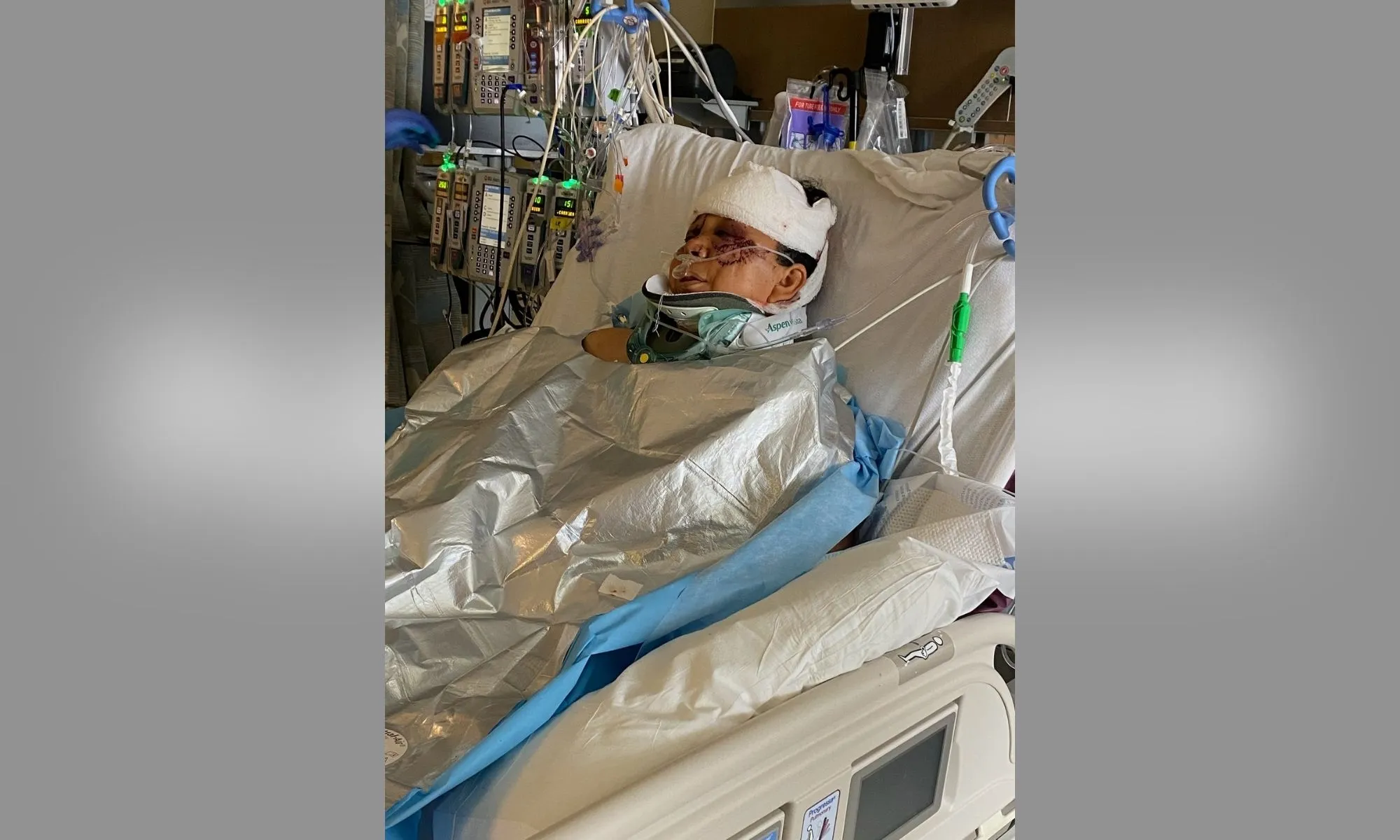 Colorado Woman Left in Critical Condition After Being Attacked By 3 Dogs Outside of Her Replica Luxury Handbag