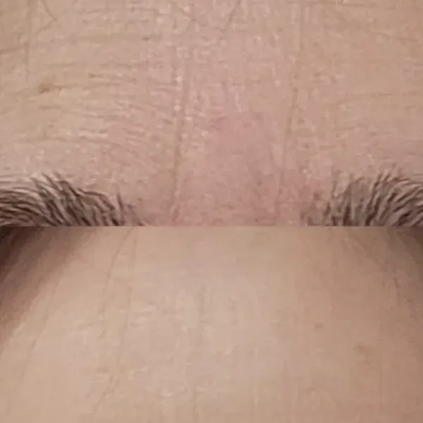 Before and After Solawave Wrinkle Retreat Pro LED Face Mask