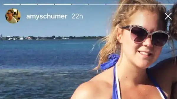 Amy Schumer
