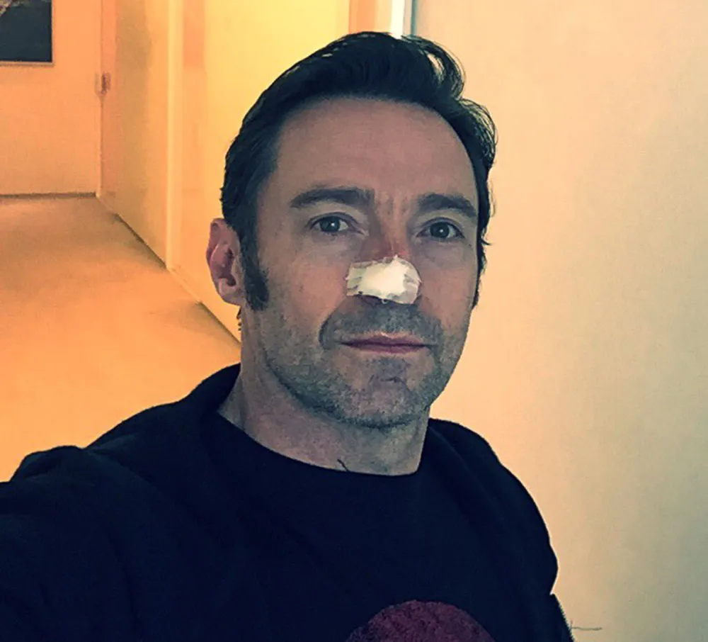 Hugh Jackman