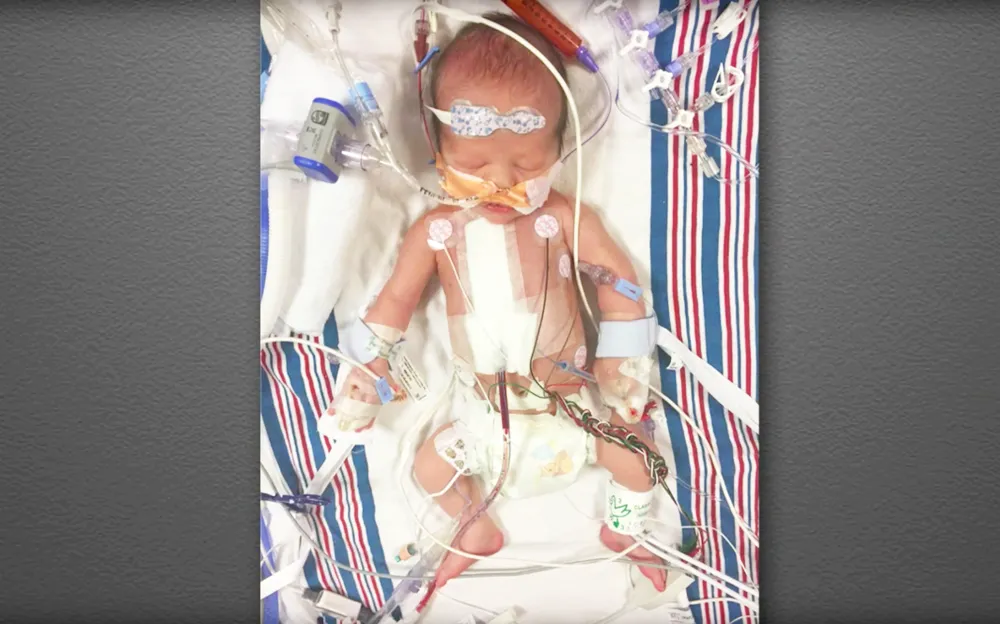 William "Billy" John Kimmel