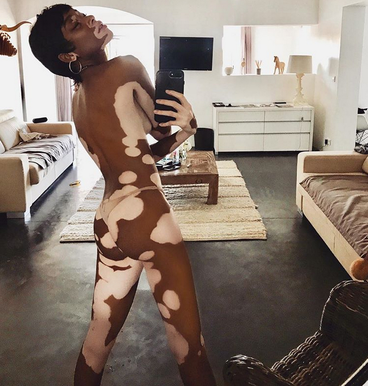 Winnie harlow naked 9b2d9c43 edfe 42d7 ab3e 1962cb7e2544